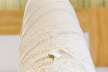 Leg wrapped with elastic medical bandage, fixed with plastic clip