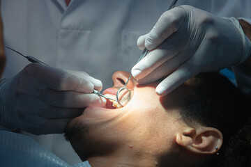 Odontologia avanzada, cuidados confiables. Joven paciente afro-americano en una clinica dentista realizando una limpieza bucal . Dentista examinando los dientes del paciente en una clinica profesional - obrazy, fototapety, plakaty
