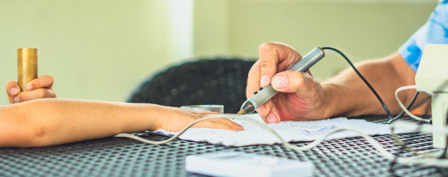 Vegetative rezonans diagnostic. Doctor examines child boy hand with the help of bioresonance dipstick tester, reveal disease causing bacteria via electromagnetic fields based on biofeedback principle