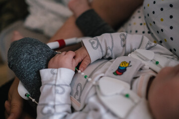 Baby mit Hüftbeugeschiene