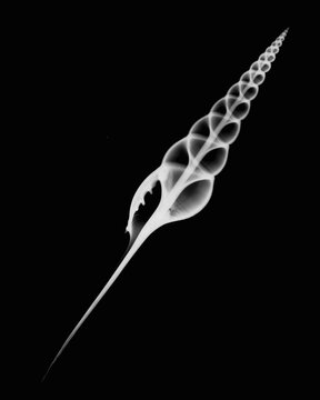 Inverted image of tibia fusis