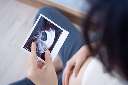 A pregnant woman is looking at an ultrasound photo of fetus. Mother gently touches the baby on stomach.Women are pregnant for 2-3 days or during the first trimester.