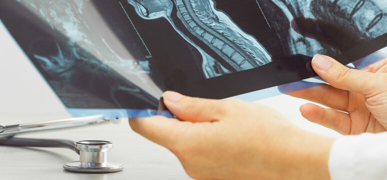 Female doctors hand pointing at x-ray or MRI medical imaging with a head and neck condition. Spinal cord, blood vessels. Neuro medicine. Healthcare and medicine. Injury. Bone tissues. Banner