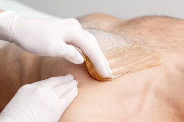Epilation chest of young male with liquid wax paste by hands of female cosmetologist in beauty salon