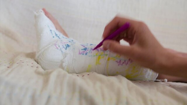 broken leg. damage to the bones. a child paints a plaster. a girl with a marker