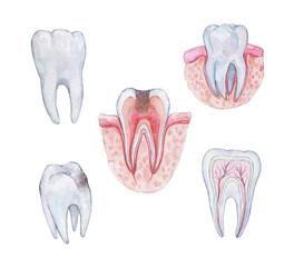  schemes of  healthy tooth anatomy in a cross section and cavity
