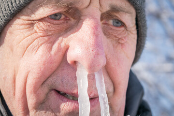Portrait of an elderly man with icicles in his nose. The man's snot was frozen in his nose. Runny...