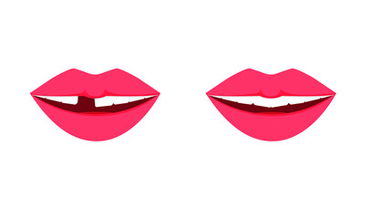 Female mouth, pink lips, white teeth, missing one tooth, toothless smile. Concept: tooth loss, extraction, dentistry. Vector illustration, flat cartoon design, isolated on white background, eps 10.