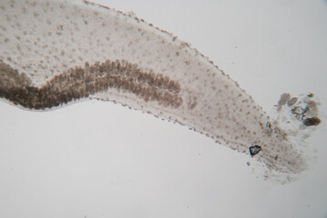 The study parasite or worms is a freshwater fish parasite in laboratory for education.
