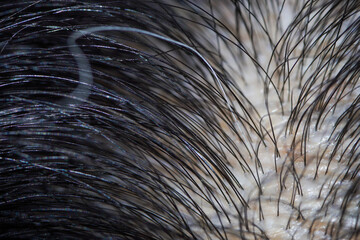 Macro photo of human scalp with a strand of white hair, close up photo of a white hair strand.