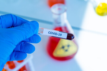 test tube containing blood sample infection from flu disease tested in medical science laboratory