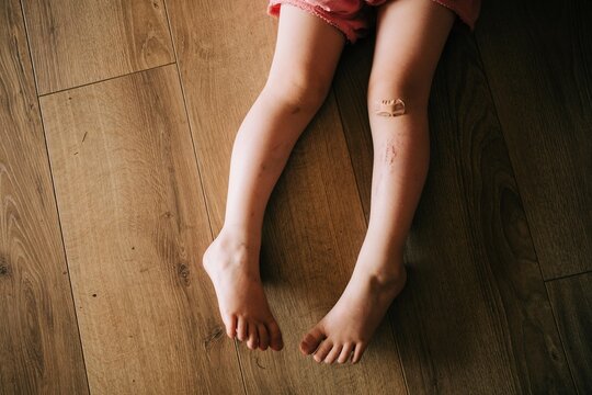 toddler with a bandage on her knee
