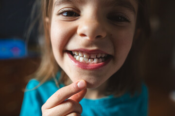 girl shows of new adult teeth