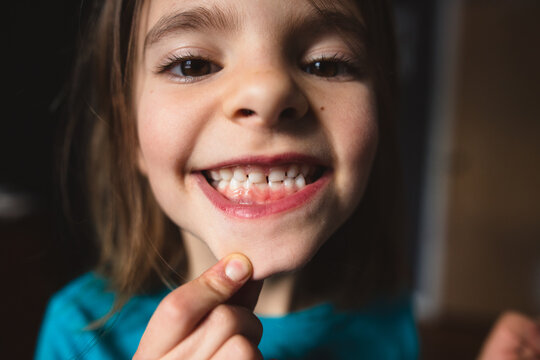 girl shows of new adult teeth
