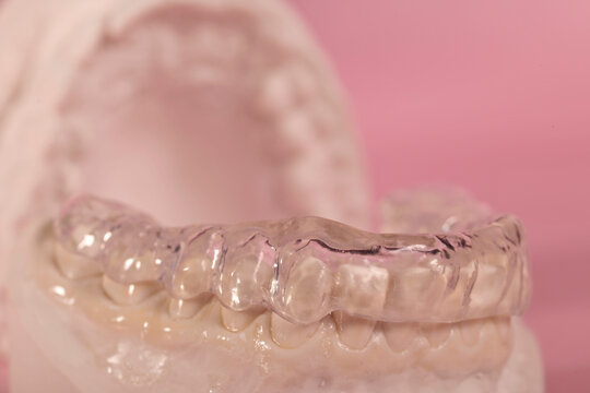 dental splint for bruxism