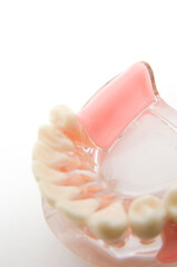 部分入歯の模型