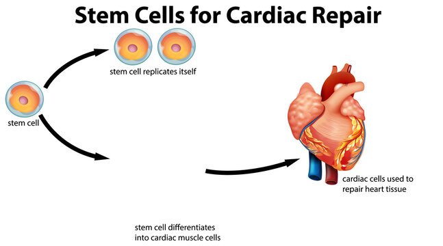 Stem cells for cardiac repair