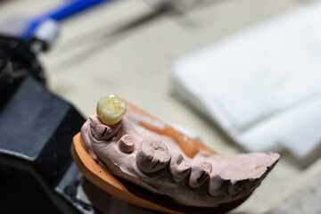 Dental Laboratory with a final prosthetic tooth in a top view.