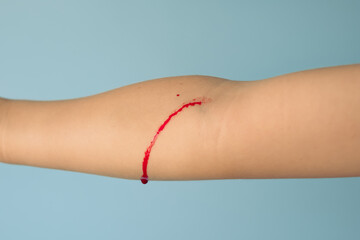 pierced hand on a vein, blood flows on the child's arm