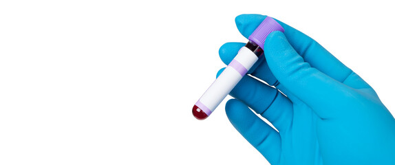 Coronavirus 2019-nCoV Blood Sample.