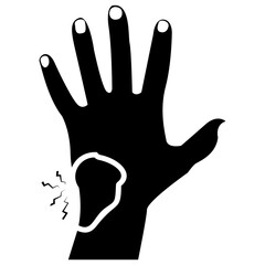 Fototapeta premium Hand Bleeding 