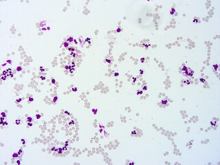 Histology of human tissue, show  epithelial tissue and connective tissue with microscope view  from laboratory (not Illustration Designation)