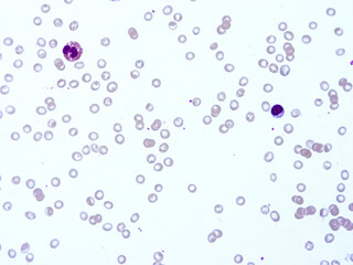 Histology of human tissue, show  epithelial tissue and connective tissue with microscope view  from laboratory (not Illustration Designation)