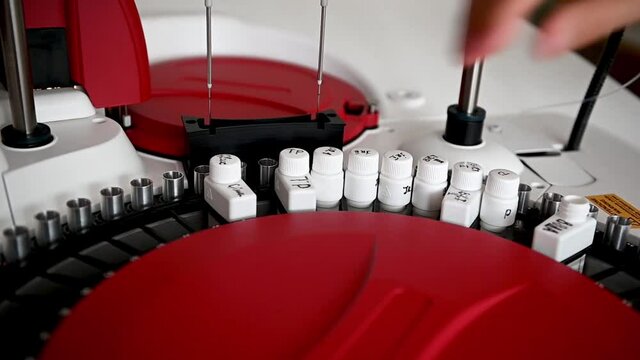 A nurse sorts blood tests in a centrifuge for examination