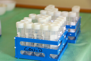 Mehrere Covid-19 Teströhrchen stehen in einem Ständer. 