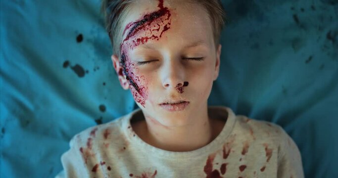 Close up of boy with head injuries lying on medical stratcher in ambulance. Top view of little child with wound and blood on his head riding with paramedics to hospital after accident
