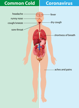 Different between common cold and coronavirus