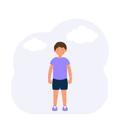 Flat vector illustration children allergy concept. Boy with hives on the body. Measles, rubella, allergy.