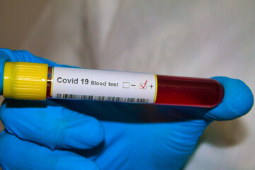 BLOOD TEST CORONA VIRUS 19