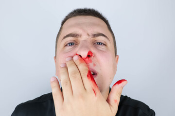 The man has a broken nose after a fight. Blood on hands, cheeks and nose. The consequences of...