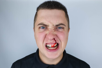 The man shakes his fists, shows aggressive behavior and has a broken nose. The concept of male brawls, fights and unrestrained aggression. Isolated on white background