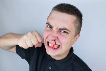 The man shakes his fists, shows aggressive behavior and has a broken nose. The concept of male...