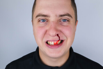 The man is bleeding from his nose, but he smiles. It feels like he likes it. The concept of...