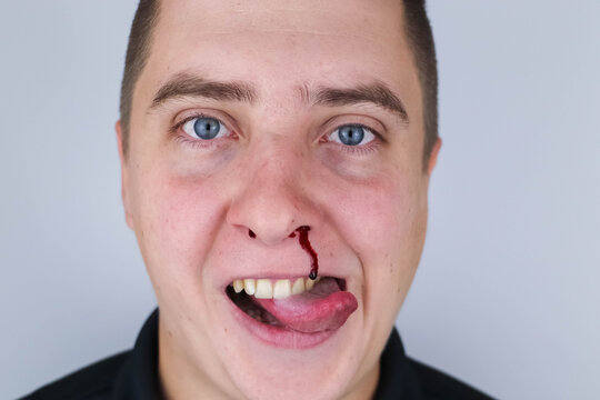 The man is bleeding from his nose, but he smiles. It feels like he likes it. The concept of mazahism, drug addiction, madness and non-standard behavior.