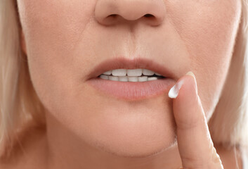 Naklejka premium Woman with cold sore applying cream on lips, closeup