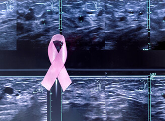 Pink breast cancer awareness loop on a mammography or ultrasound background - obrazy, fototapety, plakaty