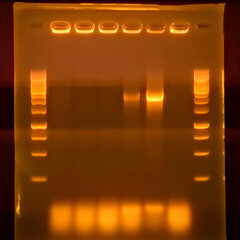 result of agarose gel electrophoresis of PCR products. separation of DNA fragments amplified with the PCR is used for genotyping of transgenic lines in search for heterozygeous lines with tDNA insert