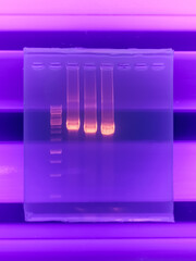 result of agarose gel electrophoresis of PCR products. separation of DNA fragments amplified with...