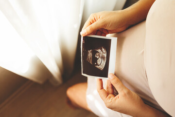Pregnant woman looking at ultrasound scan of baby, close up of scan.