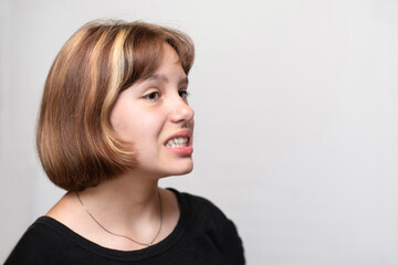 Fototapeta premium The teenage girl has grown a little crooked teeth she needs to go to the orthodontist to install braces to align the teeth. Dental concept