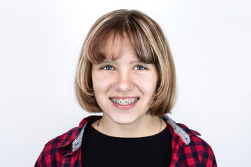 Beautiful young teenage girl happily smiles and dreams of healthy straight teeth, the girl has braces on her upper jaw to align her teeth © Мар'ян Філь