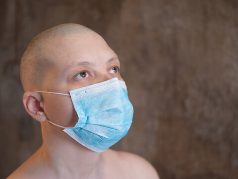 Attractive Girl With Shaved Bald Head In Medical Mask With Bare Shoulders. Beautiful Middle Age Woman Cancer Patient Without Hair