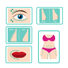 Plastic surgery icon set in flat style Surgical markings on the face and body Image before and after surgery