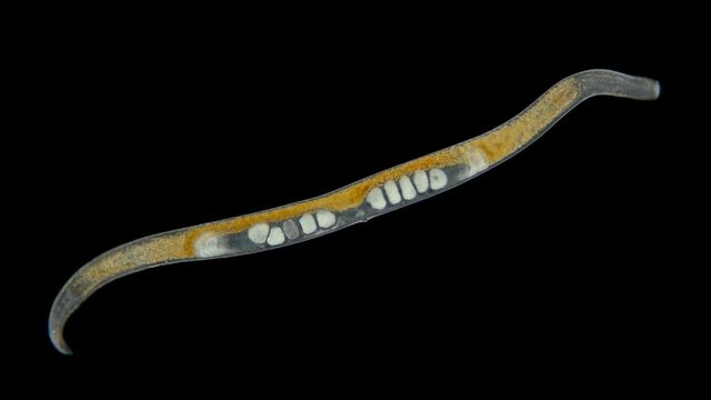 worm Nematoda under the microscope, Phylum Protostomia, free-living nematodes inhabit soil, freshwater and sea. Sample found in the Black Sea