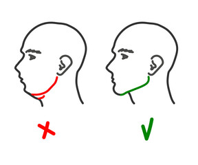Silhouette of a male head on a white background. Correction of the shape of the face and chin. Vector illustration. © alina_polina