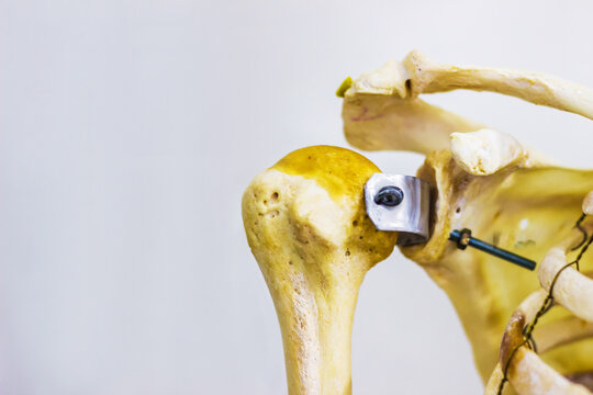 รูปภาพTrochanter – เลือกดูภาพถ่ายสต็อก เวกเตอร์ และวิดีโอ208 | Adobe Stock